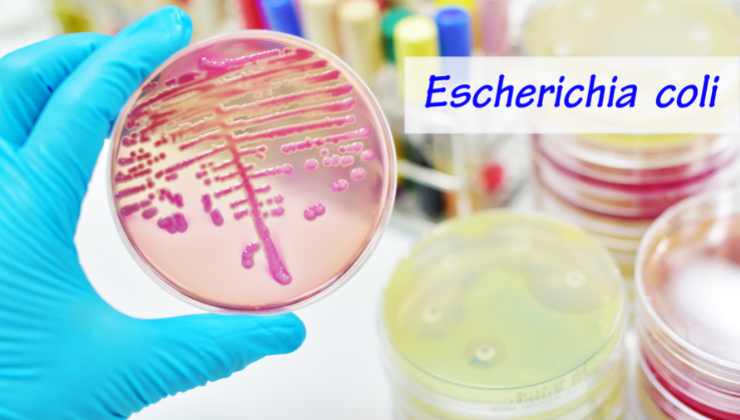 Escherichia coli bagno